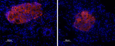 Expression of P2X7 Receptor in rat pancreas