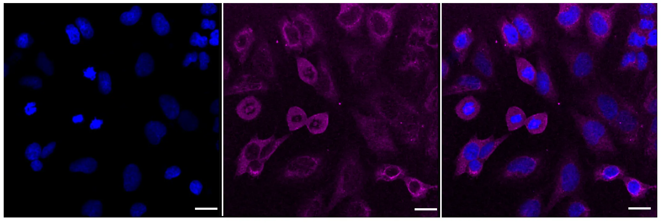 KVAb01695