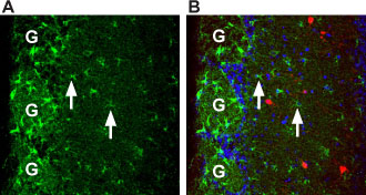 Expression of Prokineticin receptor 1 in mouse brain