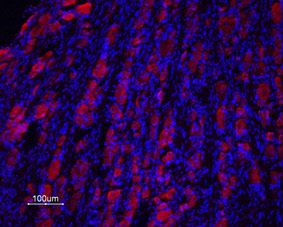 Expression of Prokineticin receptor 2 in rat DRG