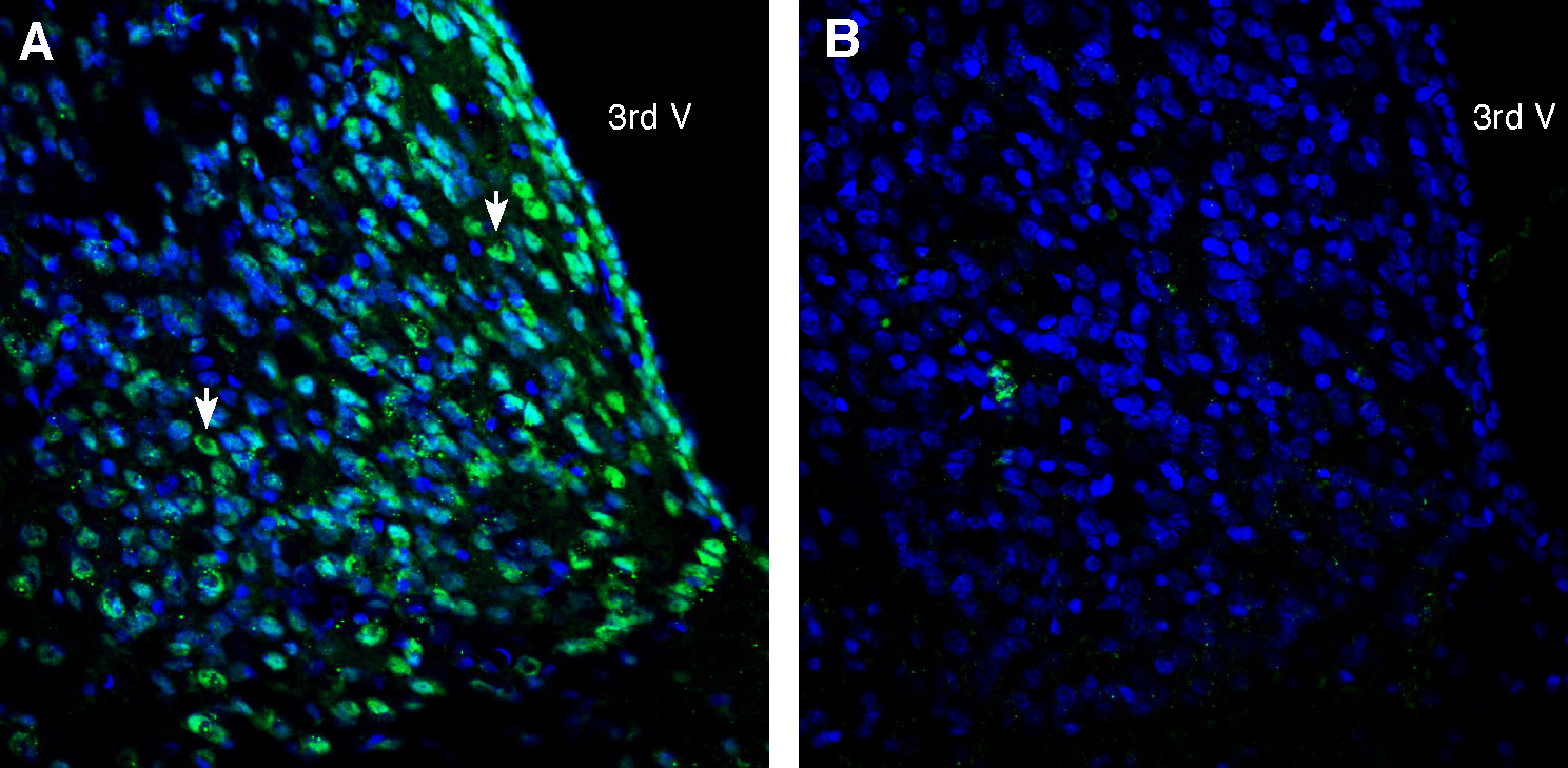 Expression of CD81 in rat medial habenula.