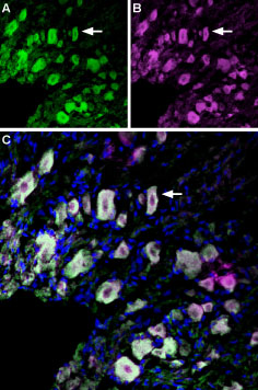 Immunolocalization of p75 NTR and TrkA in rat dorsal root ganglion