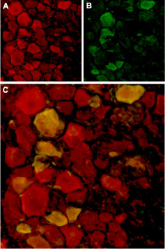 Expression of TRPV4 in rat DRG