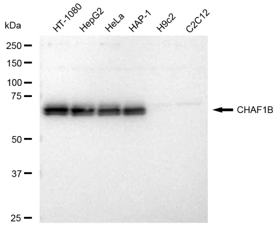 KVAb01547