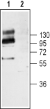 Western blot analysis of mouse brain lysates: