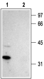 Western blot analysis of rat brain membranes: