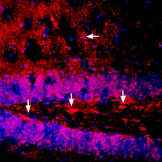 Expression of Na + /K + ATPase α1 (ATP1A1) in mouse brain