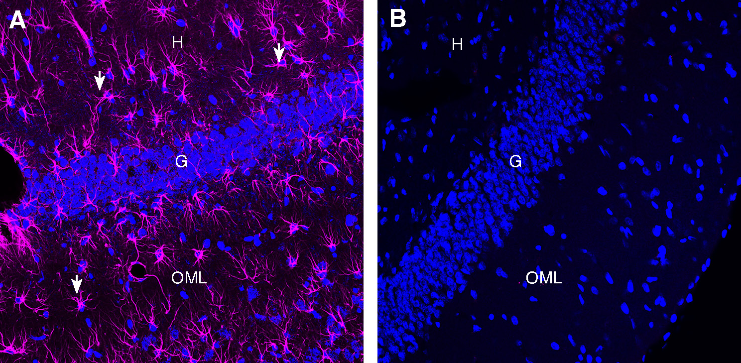 Expression of GFAP in rat hippocampus.