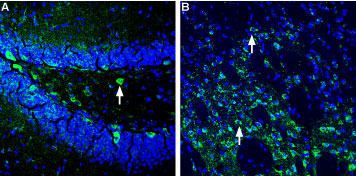 Expression of Homer1 in mouse hippocampus and striatum