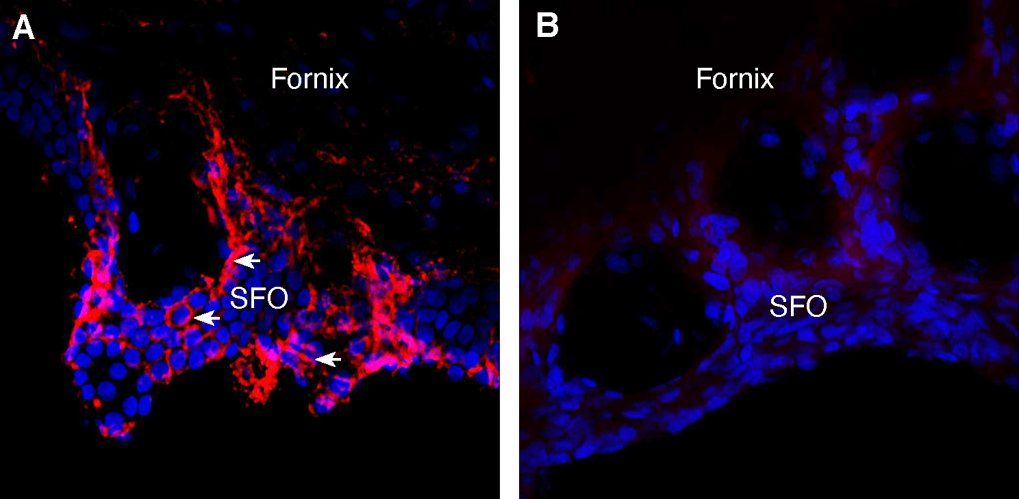 Expression of Aquaporin 4 in rat subfornical organ (SFO).
