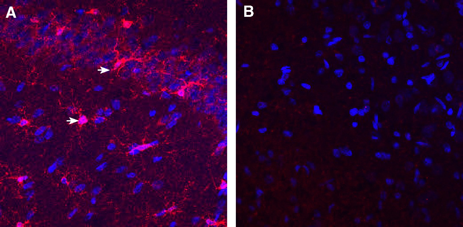 Expression of IBA1/AIF1 in rat hippocampus
