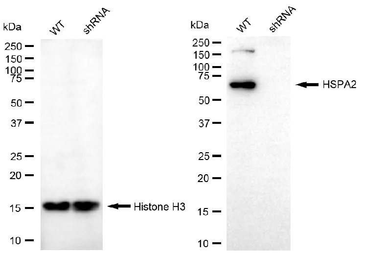 KVAb01879