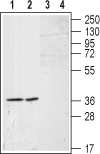 Western blot analysis of (RAEC) rat aortic endothelial cell line lysates (lanes 1 and 3) and A-10 Rat thoracic aorta smooth muscle (lane 2 and 4) cell lysates: