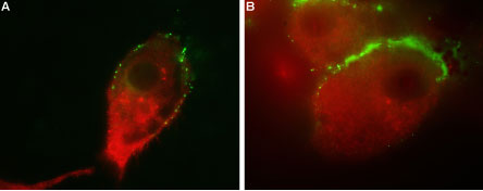 Multiplex staining of GluR1 and Vesicular GABA Transporter in human U-87 MG cells