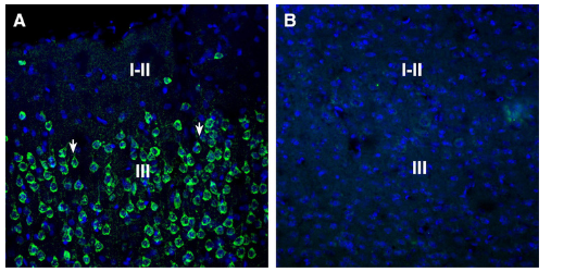 Expression of SORL1 in rat parietal cortex.
