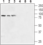 Western blot analysis of human prostate carcinoma cell lines (LNCaP (lanes 1 and 4) , DU145 (lanes 2 and 5) , PC-3 (lanes 3 and 6) ) lysates: