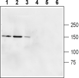 Western blot analysis of rat brain membranes (lanes 1 and 4), mouse brain membranes (lanes 2 and 5) and human U87-MG glioblastoma cell lysate (lines 3 and 6):