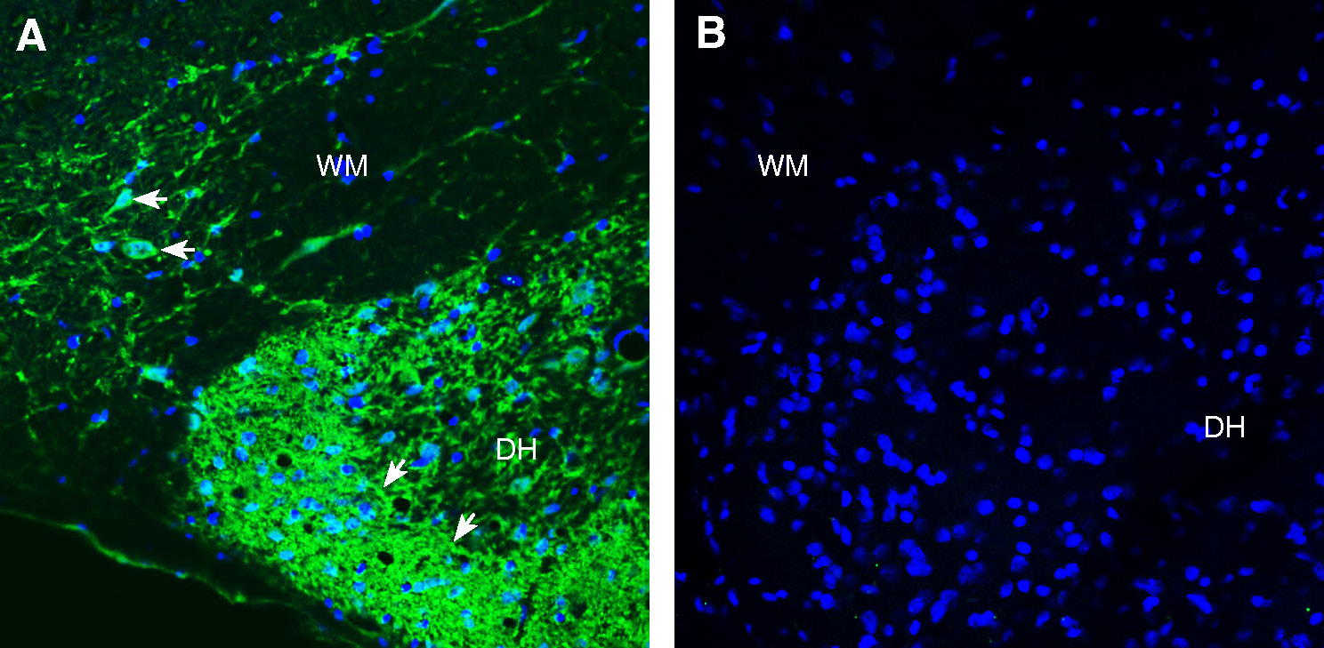 Expression of L1CAM in rat spinal cord.