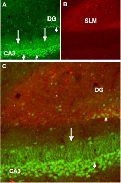 Expression of GABA(B) receptor 1 in mouse hippocampus