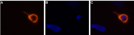 Expression of TRPV3 in rat DRG primary culture