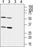 Western blot analysis of mouse (lanes 1 and 3) and rat (lanes 2 and 4) heart membranes :