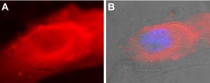 Expression of SERCA2 in mouse C2C12 cells