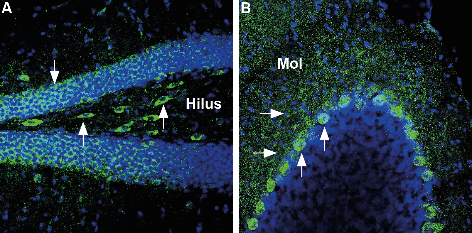 Expression of Glucose transporter 3 in mouse hippocampus and cerebellum