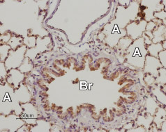 Expression of Adenosine A 2B Receptor in rat lung