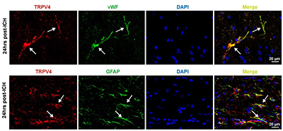 Expression of TRPV4 in rat perihematomal area following ICH.