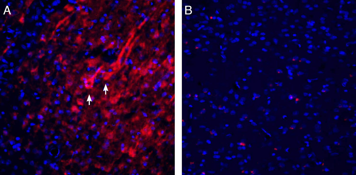 Expression of Homer1 in rat parietal cortex.