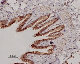 Expression of β 2 -Adrenoceptor in rat lung