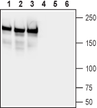 Western blot analysis of rat brain (lanes 1 and 4), mouse brain (lanes 2 and 5) and rat hippocampus (lanes 3 and 6) lysates: