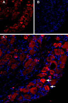 Expression of TRPV1 in rat DRGs