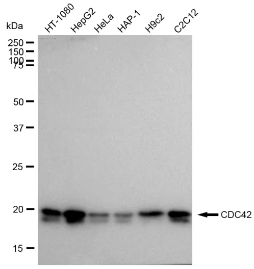 KVAb01045