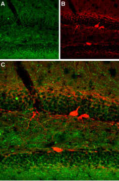 Expression of SERT in mouse brain