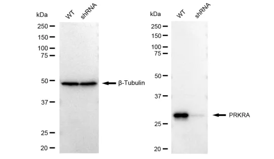 KVAb00245
