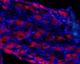 Expression of GRIA4 (GluR4) in rat DRG