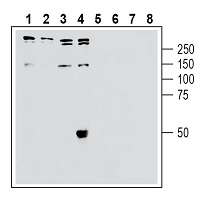 Western blot analysis of human Jurkat T-cell leukemia cell line lysate (lanes 1 and 5), human SH-SY5Y neuroblastoma cell line lysate (lanes 2 and 6), human Colo-205 colon adenocarcinoma cell line lysate (lanes 3 and 7) and HepG2 hepatocellular carcinom