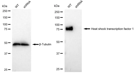 KVAb01523