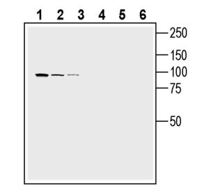 Western blot analysis of mouse BV-2 microglia cell line lysate (lanes 1 and 4), mouse TK-1 T-cell lymphoma cell line lysate (lanes 2 and 5) and mouse P815 mastocytoma cell line lysate (lanes 3 and 6):