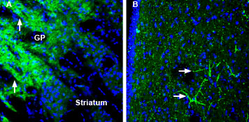 Expression of SynGAP in mouse globus pallidus and rat lateral septum