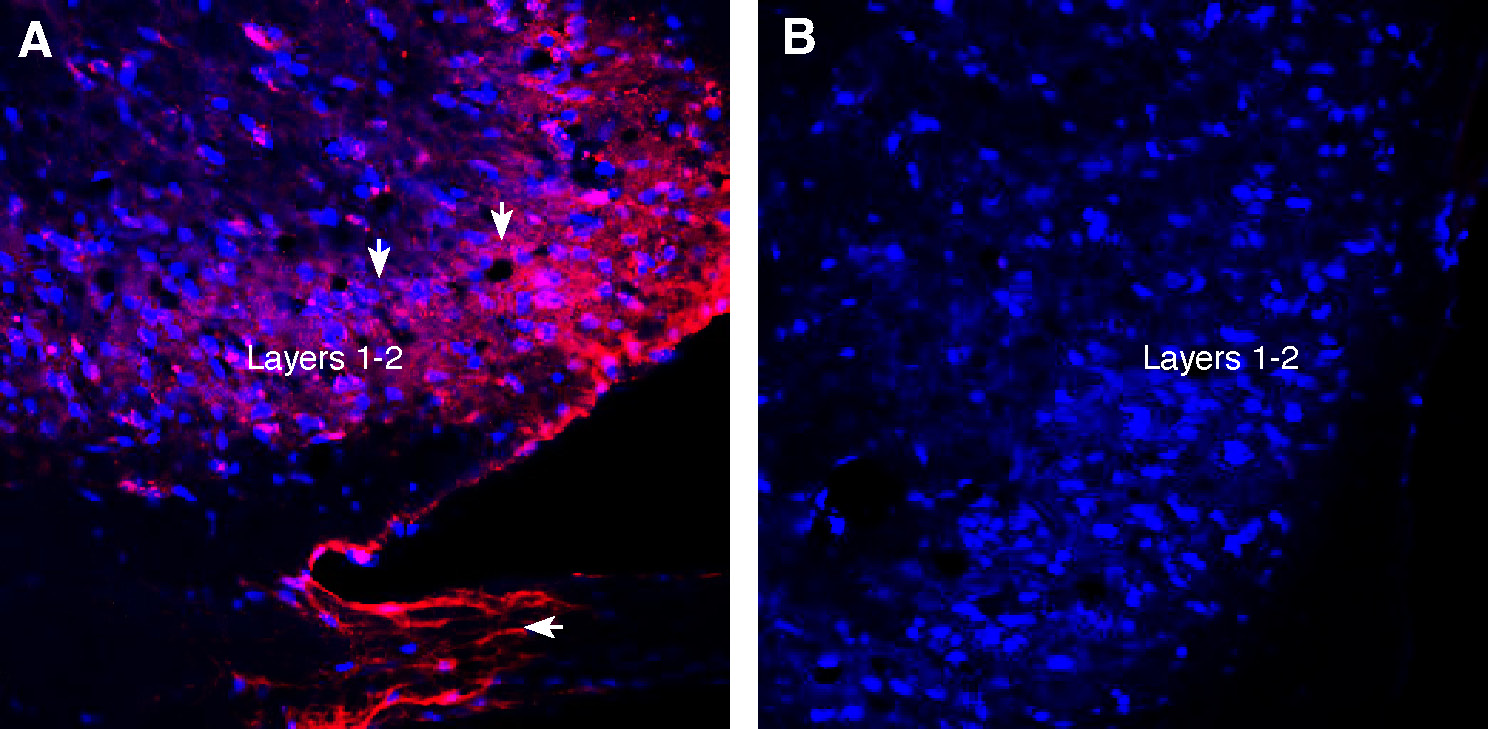Expression of VGLUT1 in rat spinal cord.