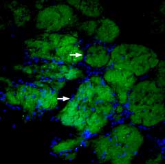 Expression of CD56 in rat brain