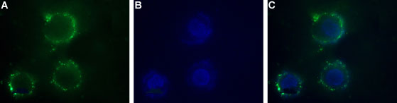 Expression of P2X1 Receptor in human SH-SYS5 cells
