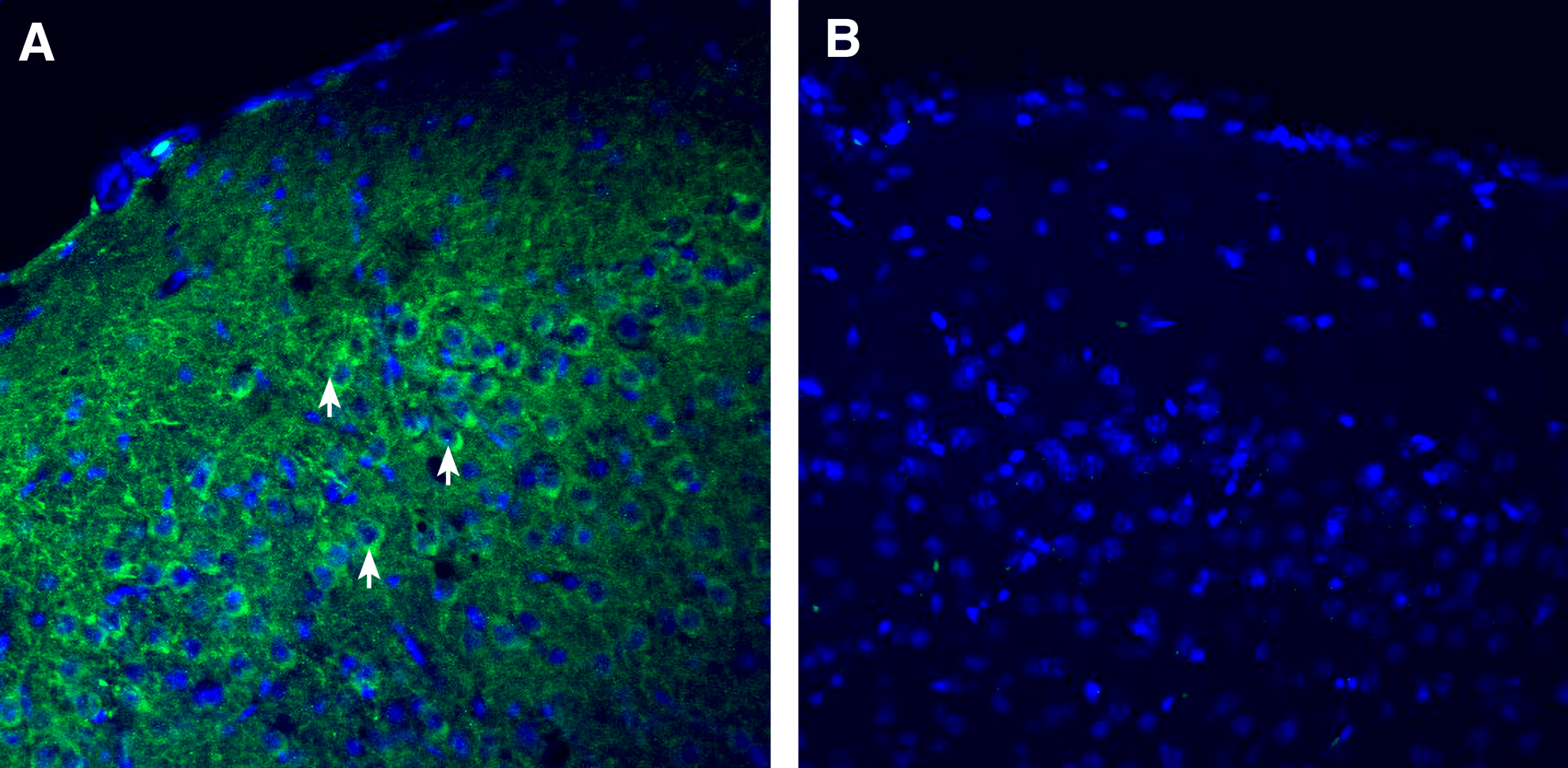 Secreted protein acidic and rich in cysteine (SPARC) in mouse temporal cortex