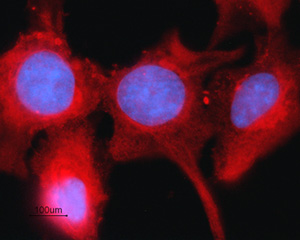 Expression of Connexin-43 in rat intestinal epithelial IEC-6 cells
