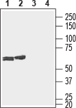 Western blot analysis of rat (lanes 1 and 3) and mouse (lanes 2 and 4) brain lysates :