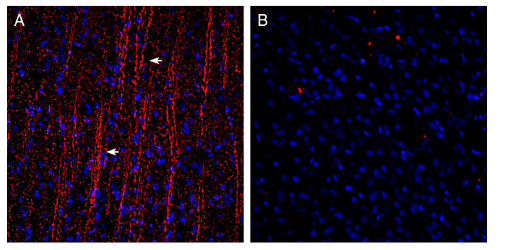 Expression of P2Y12 in rat parietal cortex.