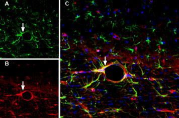Multiplex staining of GFAP and AQP4 in rat brain