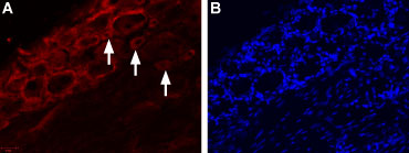 Expression of TRPV4 in rat DRG